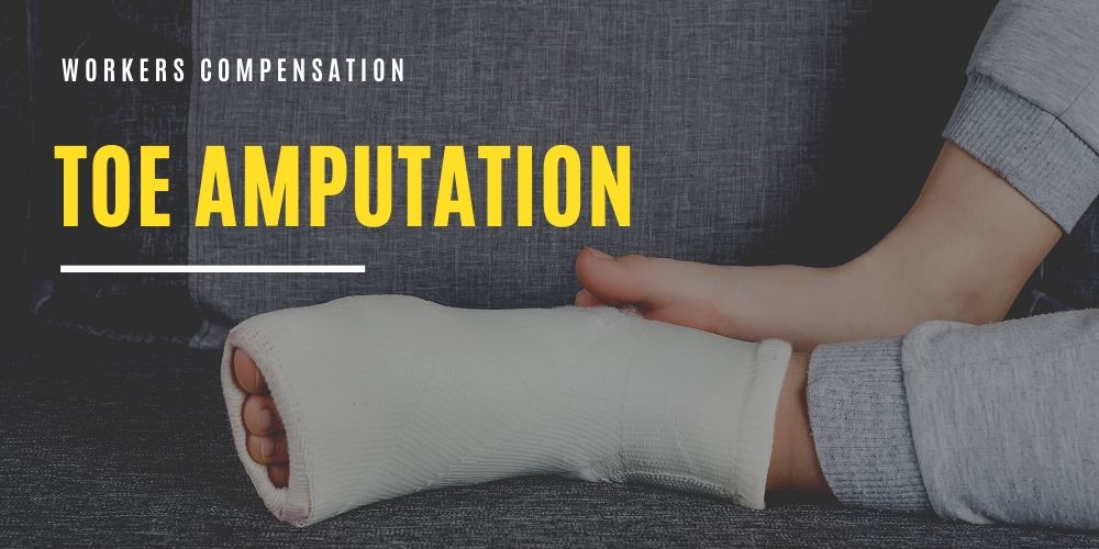 Abogado de Lesiones por Amputación de Dedo del Pie