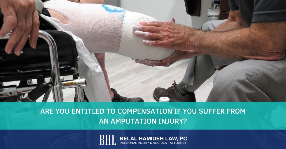 Los Angeles Catastrophic Injury Lawyer Amputation Injury