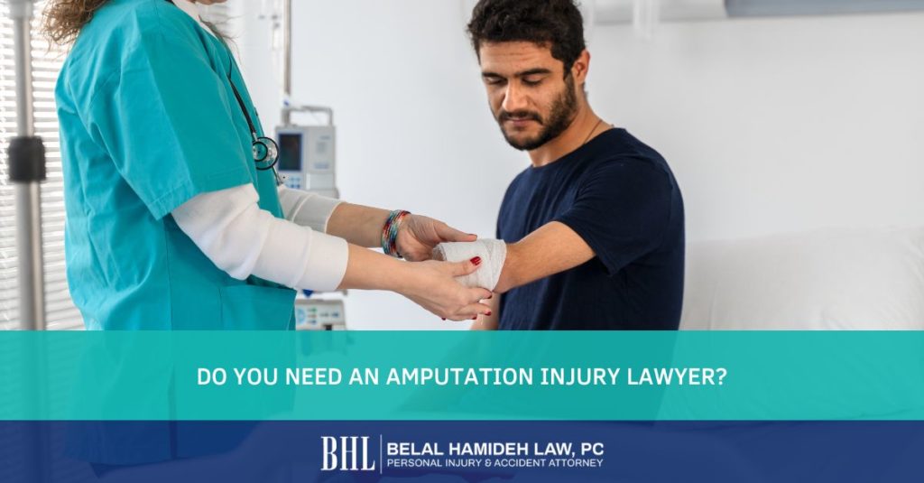 Do you Need an Amputation Injury Lawyer?