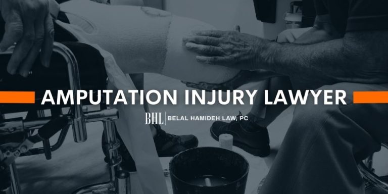 Amputation Injury Lawyer