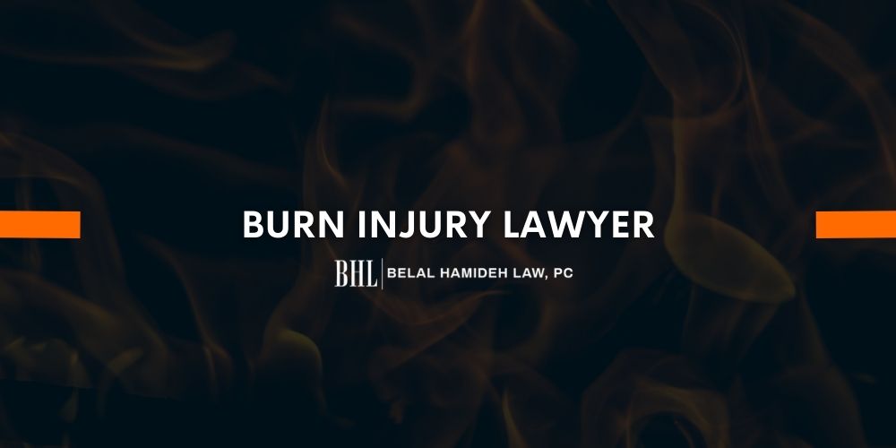 burn injury lawyer