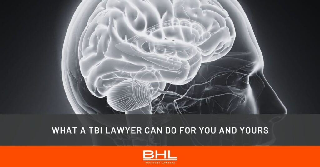 tbi lawyer