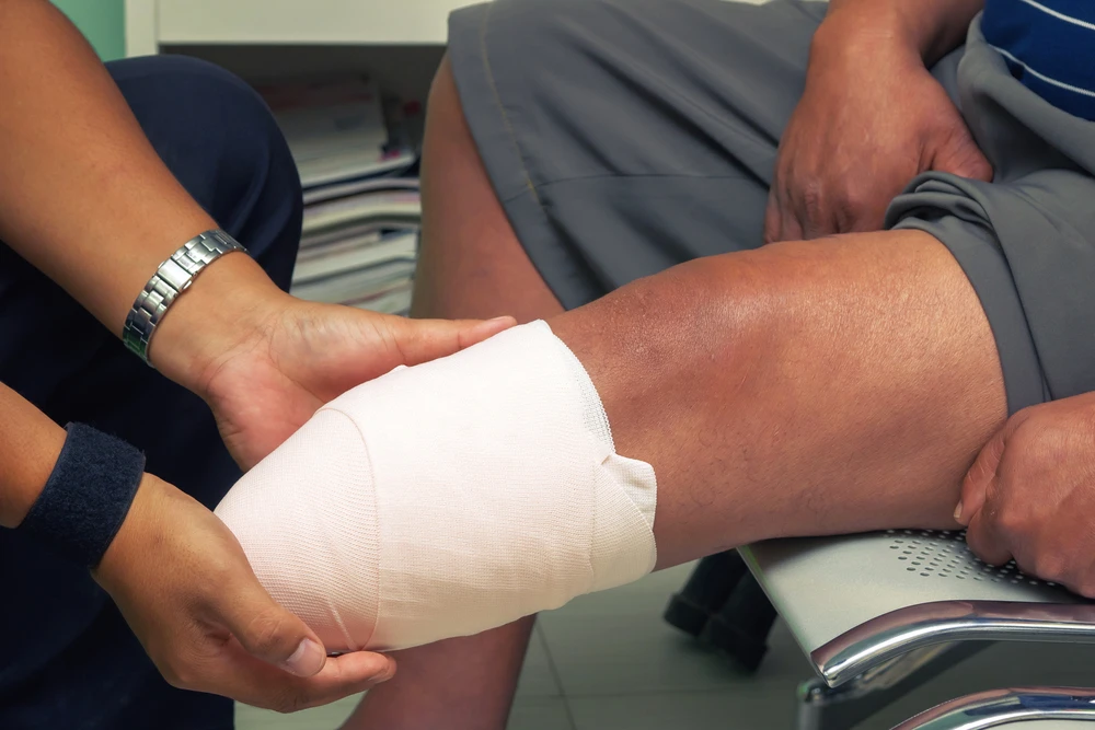 irvine catastrophic accident attorney